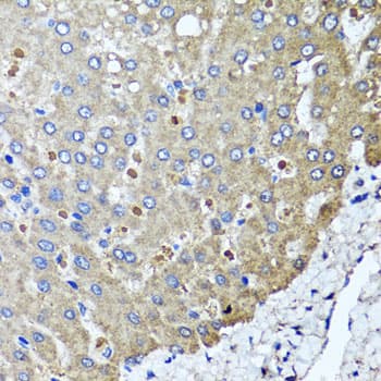 Polyclonal Rabbit anti-Human PPOX Antibody (IHC, IF, WB)