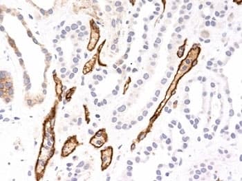 Complement C4d Antibody (clone SPM545)
