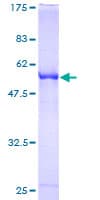 Human RABL2B Protein (Recombinant GST)