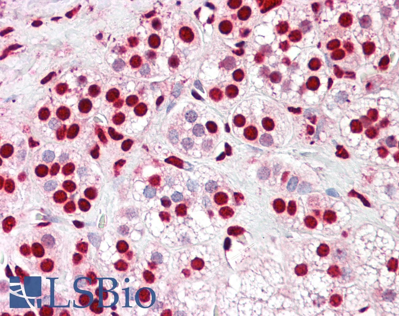 IHC-plus™ Polyclonal Rabbit anti-Human XRCC6 / Ku70 Antibody (aa1-50, IHC, WB)
