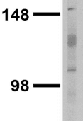GRM5 / MGLUR5 Antibody (clone S75-3)