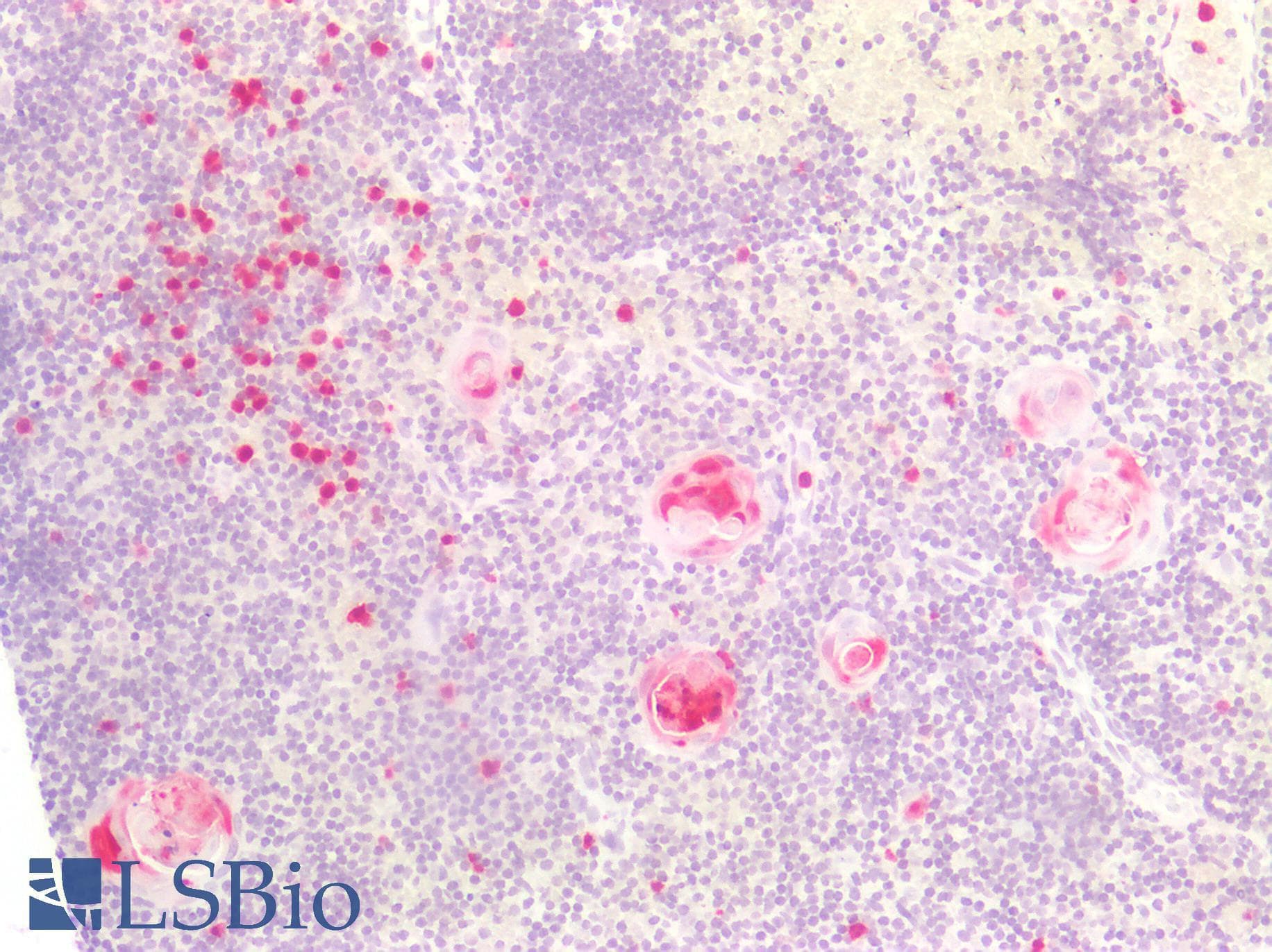 PathPlus™ Monoclonal Mouse anti-Human S100A8 / MRP8 Antibody (clone CF-145, IHC, IF, WB)