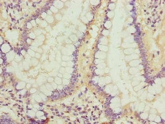 LRRC42 Antibody