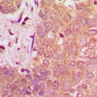 NAV1 Antibody (Internal)