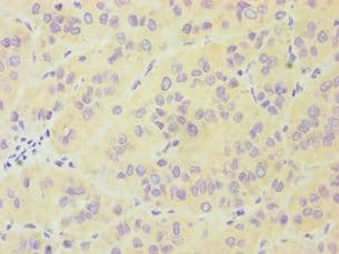 FES Antibody (aa120-420)