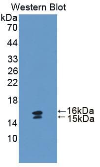 VIP Antibody (aa34-157)