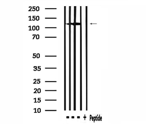 MSH3 Antibody