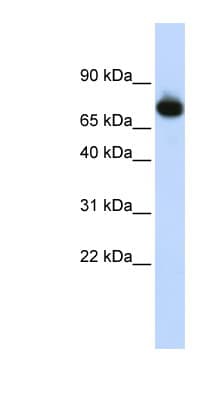 PATZ1 / PATZ Antibody (aa612-661)