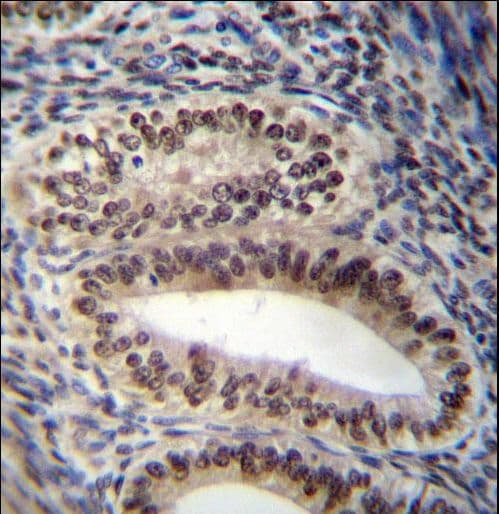 PR / Progesterone Receptor Antibody (aa349-377)