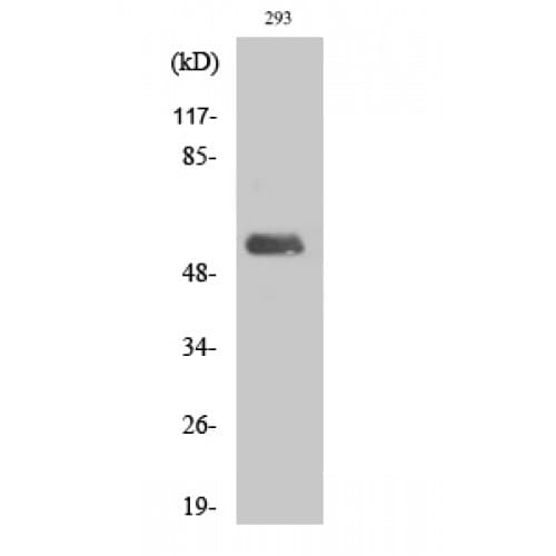 Polyclonal Rabbit anti-Human POLL / DNA Polymerase Lambda Antibody (420-500 aa, C-terminal, IHC, WB)