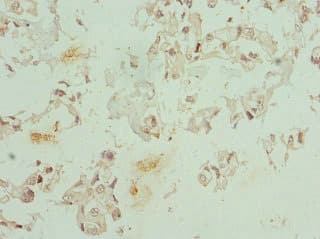 CFDP1 Antibody