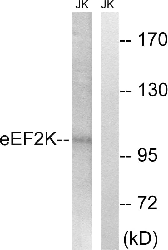 IHC-plus™ EEF2K Antibody (aa336-385)