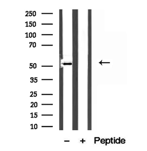 Polyclonal Rabbit anti-Human MAT / MAT1A Antibody (IHC, IF, WB)