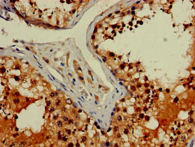 FIBP Antibody (aa2-357)