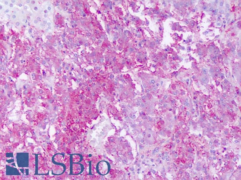 IHC-plus™ GPR161 Antibody (Cytoplasmic Domain)