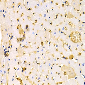 KCNH2 / HERG Antibody (aa886-899)