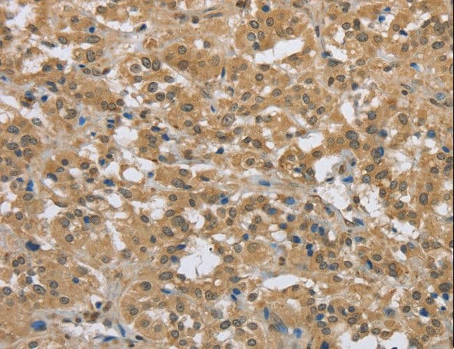 IHC-plus™ PKD1 / Polycystin Antibody (aa3725-3735)