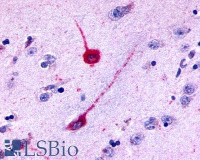 PathPlus™ HTR6 / 5-HT6 Receptor Antibody (C-Terminus)