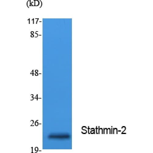 Polyclonal Rabbit anti-Human SCG10 / STMN2 Antibody (Internal, WB)