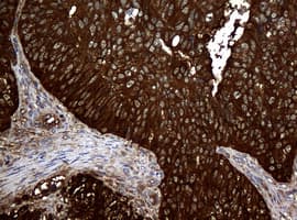 NME1 / NM23 Antibody (clone OTI3F2, Carrier-free)