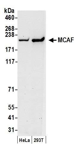 ATF7IP / MCAF1 Antibody (aa25-100)