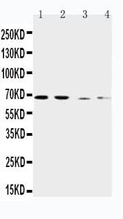 SLC7A1 / CAT1 Antibody (aa613-629)