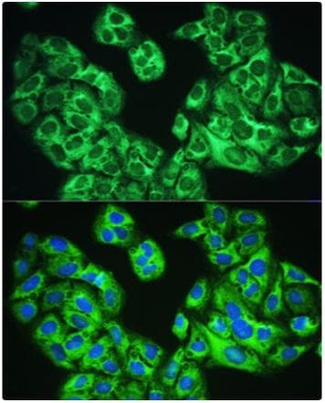 YTHDF1 Antibody