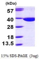 Human QPRT Protein (Recombinant His)