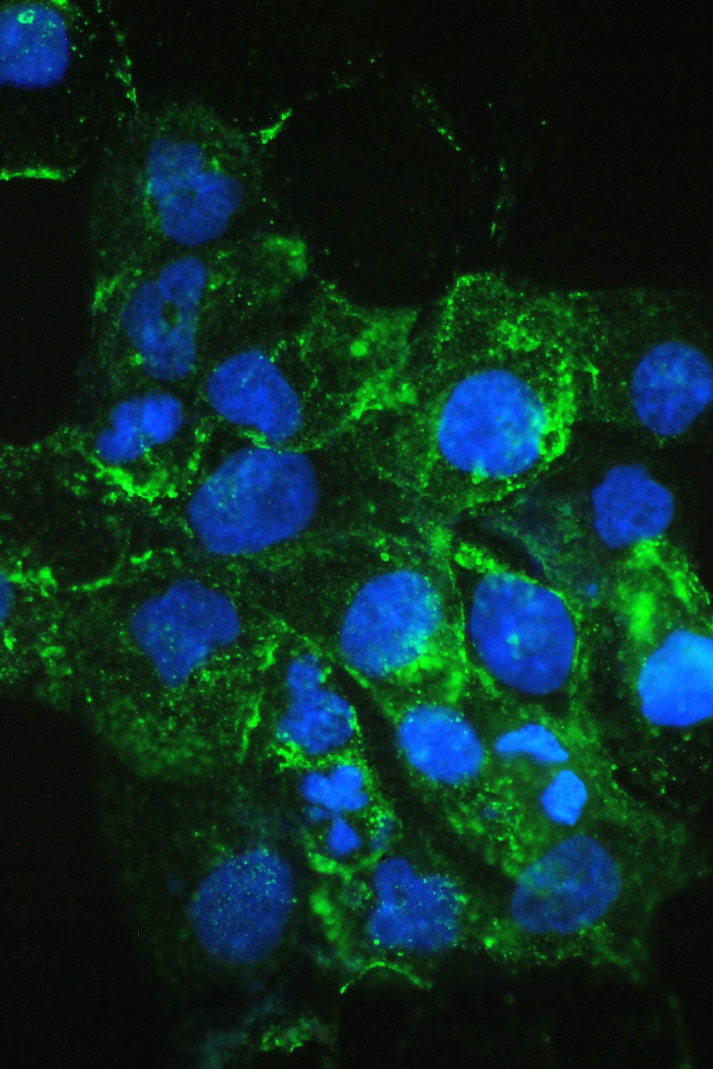 Polyclonal Rabbit anti-Human FLT4 / VEGFR3 Antibody (IHC, WB)