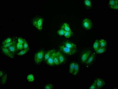 PROS1 / Protein S Antibody (aa42-676)