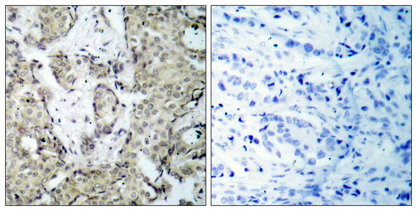 Polyclonal Rabbit anti-Human MAP2K6 / MEK6 / MKK6 Antibody (phospho-Ser207, IHC, WB)