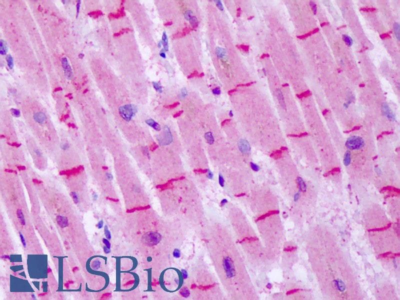 IHC-plus™ GRM8 / MGLUR8 Antibody (N-Terminus)