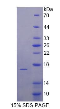 Human UPK1A / Uroplakin 1A Protein (Recombinant His-T7)