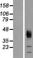 SLC36A2 Protein (Over-Expression Lysate Myc-DDK (Flag))