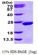 Human MDP-1 Protein (Recombinant His)