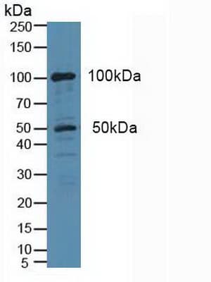 cPLA2 Antibody (aa1-178, APC)
