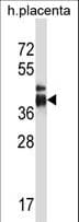 ITLN2 / Intelectin 2 Antibody (aa122-151)