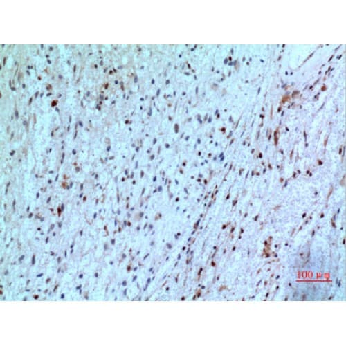 TP / Thymidine Phosphorylase Antibody (1-50 aa, N-terminal)