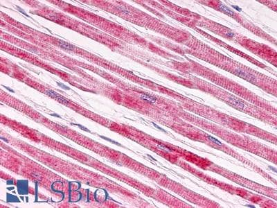 PathPlus™ GALR1 / Galanin Receptor 1 Antibody (Extracellular Domain)