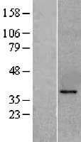 KLF6 Protein (Over-Expression Lysate Myc-DDK (Flag))