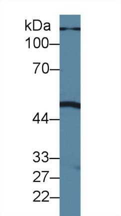 PSPLA1 / Phospholipase A1 Antibody (aa309-452, PE)