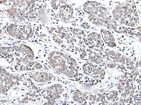 MGC11296 / BRMS1L Antibody