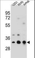 IHC-plus™ TPM4 Antibody (aa26-54)