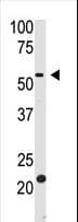 BACE2 Antibody (aa336-365)