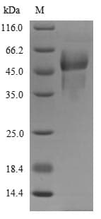 Rat PROC / Protein C (Recombinant 6His, N-terminus)