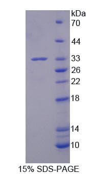 Human BRD2 / RING3 Protein (Recombinant His, N-Terminal)