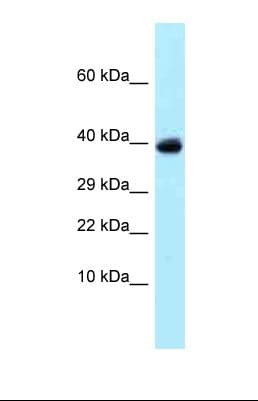 USP4 Antibody (C-Terminus)