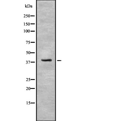 IDH3B Antibody