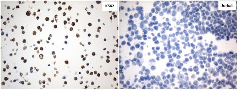CD30 Antibody (aa408-595, clone UMAB256, Carrier-free)