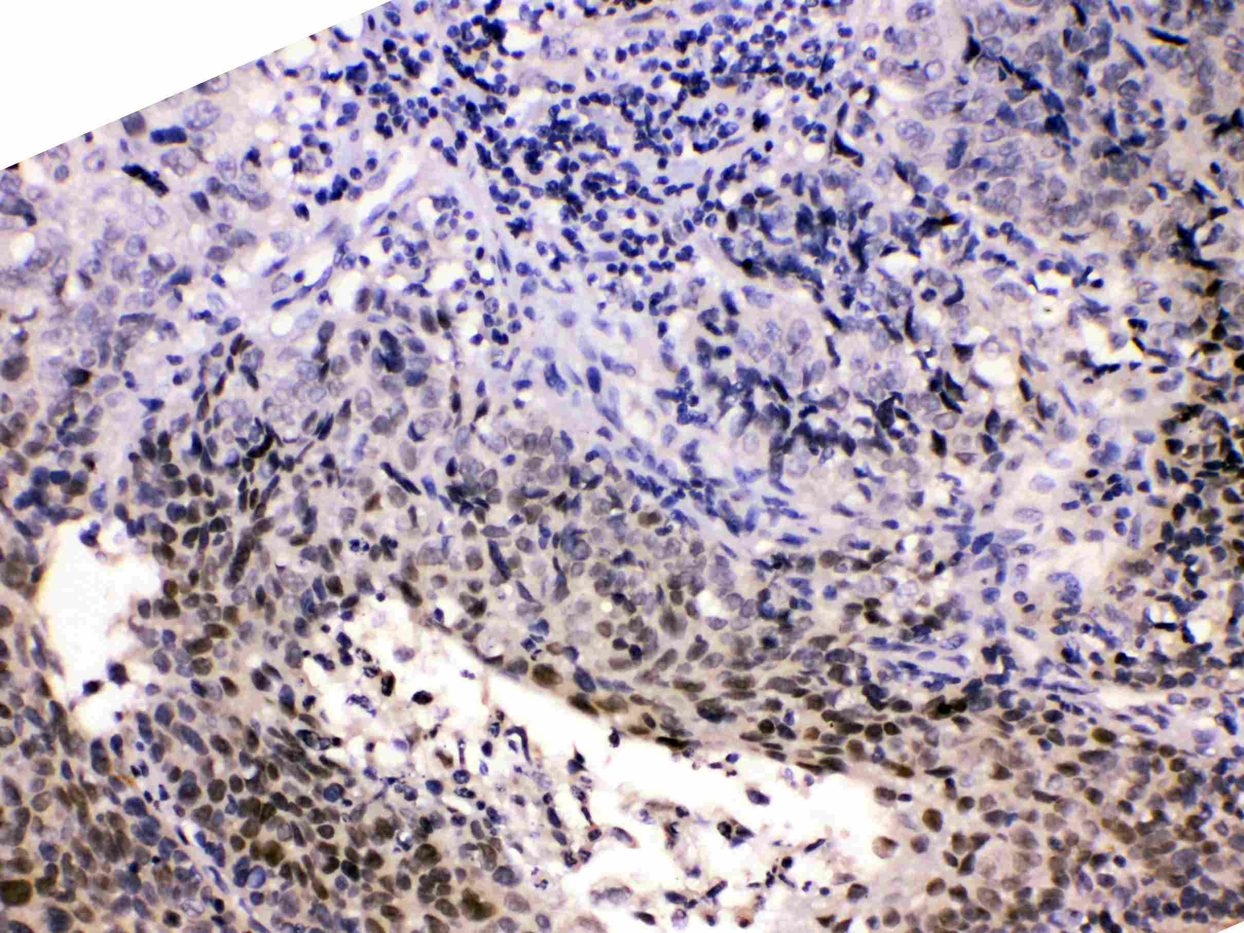 HDGF Antibody